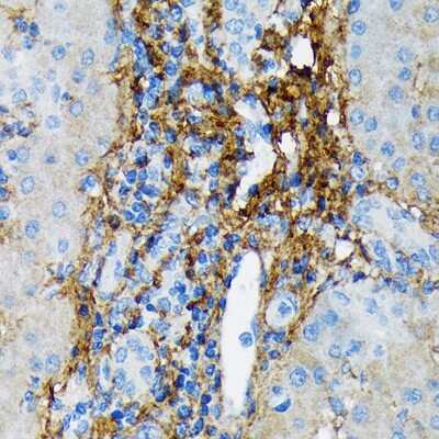 Immunohistochemistry-Paraffin: Collagen VI alpha 1 Antibody (7J1P4) [NBP3-16869] - Immunohistochemistry of paraffin-embedded human liver using Collagen VI alpha 1 Rabbit mAb (NBP3-16869) at dilution of 1:100 (40x lens).Perform microwave antigen retrieval with 10 mM Tris/EDTA buffer pH 9.0 before commencing with IHC staining protocol.