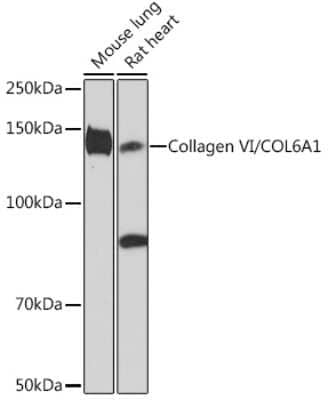 Western Blot: Collagen VI alpha 1 Antibody (7J1P4) [NBP3-16869] - Western blot analysis of extracts of various cell lines, using Collagen VI alpha 1 Rabbit mAb (NBP3-16869) at 1:1000 dilution. Secondary antibody: HRP Goat Anti-Rabbit IgG (H+L) at 1:10000 dilution. Lysates/proteins: 25ug per lane. Blocking buffer: 3% nonfat dry milk in TBST. Detection: ECL Enhanced Kit. Exposure time: 3min.