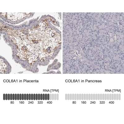 <b>Orthogonal Strategies Validation. </b>Immunohistochemistry-Paraffin: Collagen VI alpha 1 Antibody [NBP1-91193] - Analysis in human placenta and pancreas tissues. Corresponding COL6A1 RNA-seq data are presented for the same tissues.