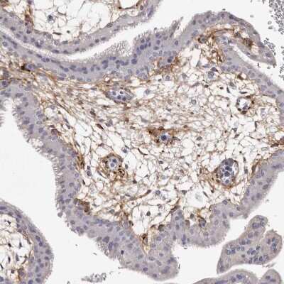 Immunohistochemistry-Paraffin: Collagen VI alpha 1 Antibody [NBP1-91193] - Staining of human placenta shows moderate positivity in extracellular matrix.