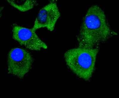 Immunocytochemistry/Immunofluorescence: Collagen VI alpha 1 Antibody (SD83-03) [NBP2-67825] - Staining Collagen VI in A549 cells (green). The nuclear counter stain is DAPI (blue). Cells were fixed in paraformaldehyde, permeabilised with 0.25% Triton X100/PBS.