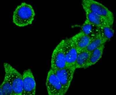 Immunocytochemistry/Immunofluorescence: Collagen VI alpha 1 Antibody (SD83-03) [NBP2-67825] - Staining Collagen VI in Hela cells (green). The nuclear counter stain is DAPI (blue). Cells were fixed in paraformaldehyde, permeabilised with 0.25% Triton X100/PBS.