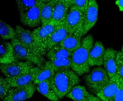 Immunocytochemistry/Immunofluorescence: Collagen VI alpha 1 Antibody (SD83-03) [NBP2-67825] - Staining Collagen VI in HepG2 cells (green). The nuclear counter stain is DAPI (blue). Cells were fixed in paraformaldehyde, permeabilised with 0.25% Triton X100/PBS.