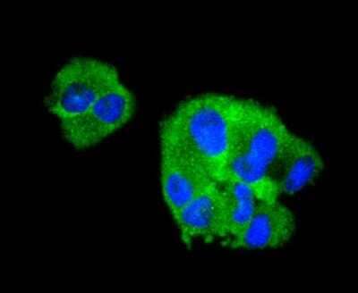 Immunocytochemistry/Immunofluorescence: Collagen VI alpha 1 Antibody (SD83-03) [NBP2-67825] - Staining Collagen VI in RH-35 cells (green). The nuclear counter stain is DAPI (blue). Cells were fixed in paraformaldehyde, permeabilised with 0.25% Triton X100/PBS.