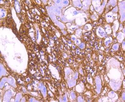 Immunohistochemistry-Paraffin: Collagen VI alpha 1 Antibody (SD83-03) [NBP2-67825] - Analysis of paraffin-embedded human liver tissue using anti-Collagen VI antibody. Counter stained with hematoxylin.