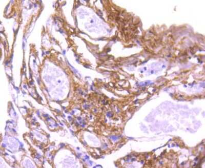 Immunohistochemistry-Paraffin: Collagen VI alpha 1 Antibody (SD83-03) [NBP2-67825] - Analysis of paraffin-embedded human lung tissue using anti-Collagen VI antibody. Counter stained with hematoxylin.