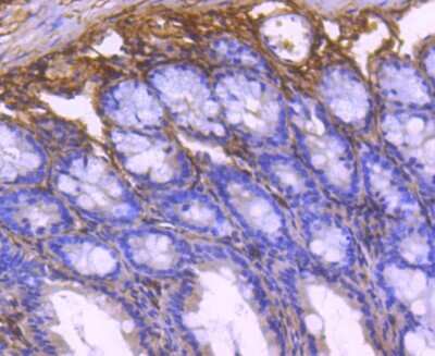 Immunohistochemistry-Paraffin: Collagen VI alpha 1 Antibody (SD83-03) [NBP2-67825] - Analysis of paraffin-embedded mouse colon tissue using anti-Collagen VI antibody. Counter stained with hematoxylin.