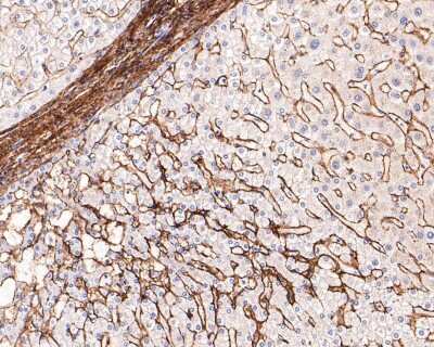 Immunohistochemistry-Paraffin: Collagen VI alpha 1 Antibody (SD83-03) [NBP2-67825] - Analysis of paraffin-embedded human liver tissue with Rabbit anti-Collagen VI antibody washed with ddH2O and PBS, and then probed with the primary antibody  at 1/400 dilution for 1 hour at room temperature. The detection was performed using an HRP conjugated compact polymer system. DAB was used as the chromogen. Tissues were counterstained with hematoxylin and mounted with DPX.