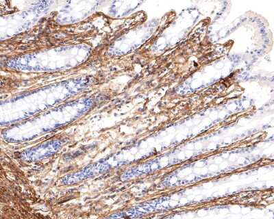 Immunohistochemistry-Paraffin: Collagen VI alpha 1 Antibody (SD83-03) [NBP2-67825] - Analysis of paraffin-embedded human colon tissue with Rabbit anti-Collagen VI alpha 1 antibody washed with ddH2O and PBS, and then probed with the primary antibody  at 1/400 dilution for 1 hour at room temperature. The detection was performed using an HRP conjugated compact polymer system. DAB was used as the chromogen. Tissues were counterstained with hematoxylin and mounted with DPX.