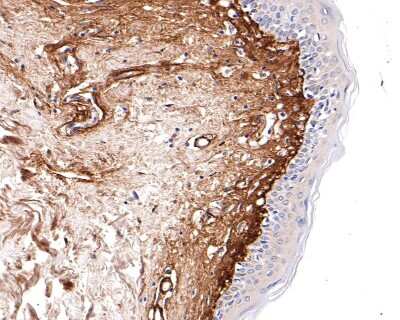 Immunohistochemistry-Paraffin: Collagen VI alpha 1 Antibody (SD83-03) [NBP2-67825] - Analysis of paraffin-embedded human skin tissue with Rabbit anti-Collagen VI antibody washed with ddH2O and PBS, and then probed with the primary antibody at 1/400 dilution for 1 hour at room temperature. The detection was performed using an HRP conjugated compact polymer system. DAB was used as the chromogen. Tissues were counterstained with hematoxylin and mounted with DPX.