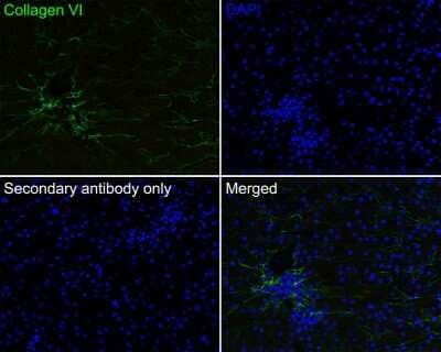 Immunohistochemistry-Paraffin: Collagen VI alpha 1 Antibody (SD83-03) [NBP2-67825] - Immunofluorescence analysis of paraffin-embedded human liver tissue labeling Collagen VI with Rabbit anti-Collagen VI antibody washed with PBS, and then probed with the primary antibody (green) at 1/100 dilution overnight at 4 , washed with PBS. Goat Anti-Rabbit IgG H&L (iFluor(TM) 488) was used as the secondary antibody at 1/1,000 dilution. Nuclei were counterstained with DAPI (blue).