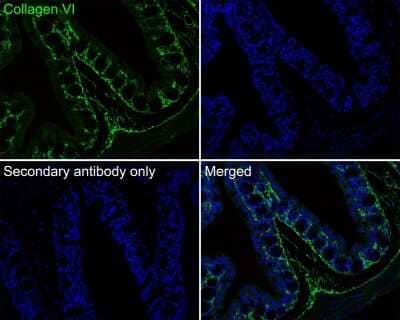 Immunohistochemistry-Paraffin: Collagen VI alpha 1 Antibody (SD83-03) [NBP2-67825] - Immunofluorescence analysis of paraffin-embedded mouse colon tissue labeling Collagen VI alpha 1 with Rabbit anti-Collagen VI alpha 1 antibody washed with PBS, and then probed with the primary antibody (green) at 1/100 dilution overnight at 4 , washed with PBS. Goat Anti-Rabbit IgG H&L (iFluor(TM) 488) was used as the secondary antibody at 1/1,000 dilution. Nuclei were counterstained with DAPI (blue).