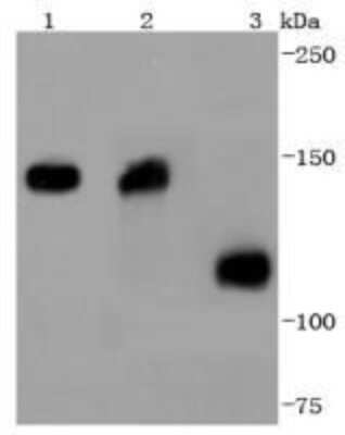 Western Blot: Collagen VI alpha 1 Antibody (SD83-03) [NBP2-67825] - Analysis of Collagen VI on different lysates using anti-Collagen VI antibody at 1/1,000 dilution. Positive control: Lane 1: Mouse heart Lane 2: Human heart Lane 3: Human kidney