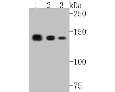 Western Blot: Collagen VI alpha 1 Antibody (SD83-03) [NBP2-67825] - Western blot analysis of Collagen VI alpha 1 on different lysates. Proteins were transferred to a PVDF membrane and blocked with 5% BSA in PBS for 1 hour at room temperature. The primary antibody (1/500) was used in 5% BSA at room temperature for 2 hours.