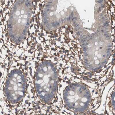 Immunohistochemistry-Paraffin: Collagen VI alpha 2 Antibody [NBP1-90951] - Staining of human colon shows strong positivity in extracellular matrix in lamina propria.