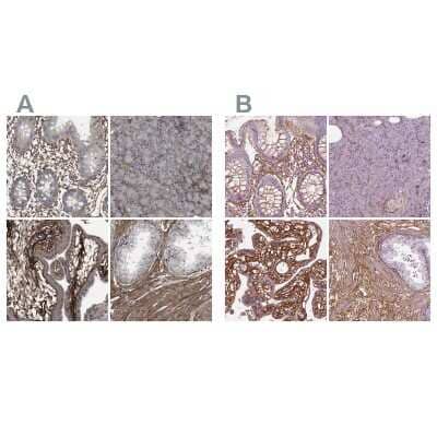 Immunohistochemistry-Paraffin: Collagen VI alpha 2 Antibody [NBP1-90951] - Staining of human gastrointestinal, pancreas, placenta and prostate using Anti-COL6A2 antibody NBP1-90951 (A) shows similar protein distribution across tissues to independent antibody NBP2-55655 (B).