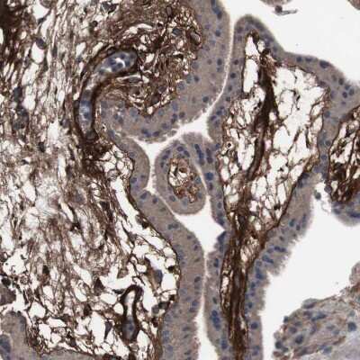 Immunohistochemistry-Paraffin: Collagen VI alpha 2 Antibody [NBP1-90951] - Staining of human placenta shows strong positivity in extracellular matrix in chorionic vlli.