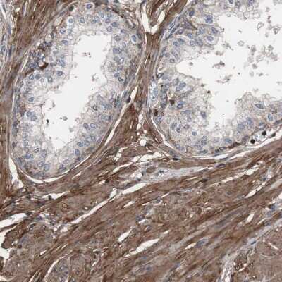 <b>Independent Antibodies Validation. </b>Immunohistochemistry-Paraffin: Collagen VI alpha 2 Antibody [NBP1-90951] - Staining of human prostate shows moderate to strong membranous and cytoplasmic positivity in smooth muscle cells.