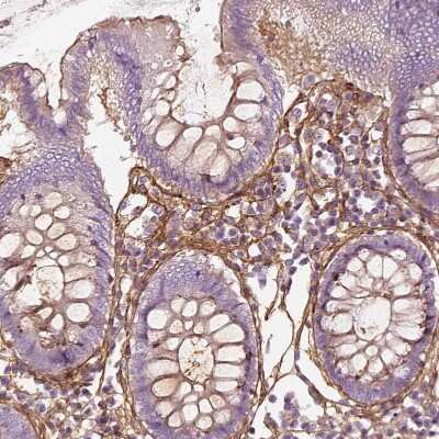 Immunohistochemistry-Paraffin: Collagen VI alpha 2 Antibody [NBP2-55655] - Staining of human colon shows strong positivity in extracellular matrix in lamina propria.