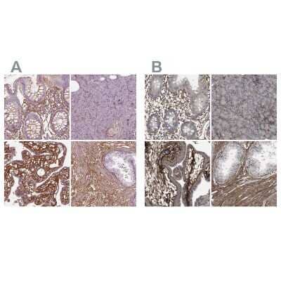 Immunohistochemistry-Paraffin: Collagen VI alpha 2 Antibody [NBP2-55655] - Staining of human gastrointestinal, pancreas, placenta and prostate using Anti-COL6A2 antibody NBP2-55655 (A) shows similar protein distribution across tissues to independent antibody NBP1-90951 (B).