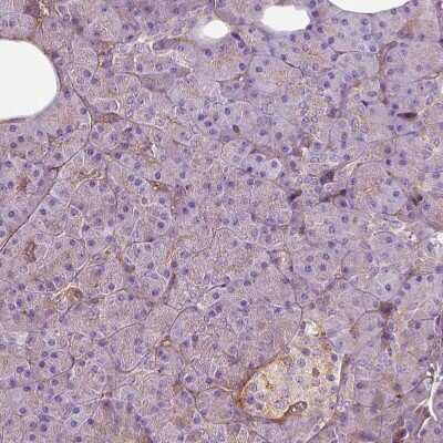 Immunohistochemistry-Paraffin: Collagen VI alpha 2 Antibody [NBP2-55655] - Staining of human pancreas shows only very weak positivity in exocrine glandular cells.