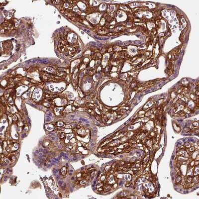 Immunohistochemistry-Paraffin: Collagen VI alpha 2 Antibody [NBP2-55655] - Staining of human placenta shows strong positivity in extracellular matrix in chorionic vlli.