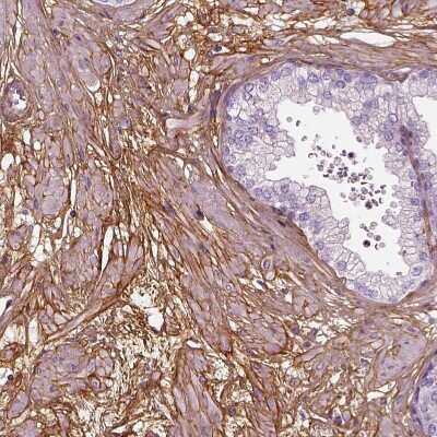 Immunohistochemistry-Paraffin: Collagen VI alpha 2 Antibody [NBP2-55655] - Staining of human prostate shows strong membranous positivity in smooth muscle cells.