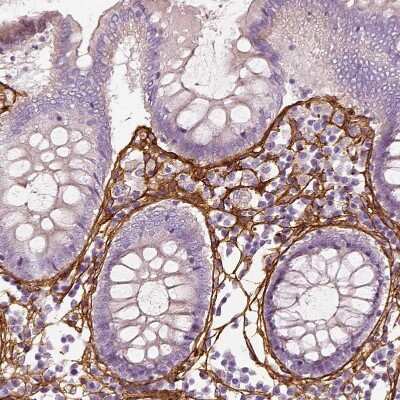 Immunohistochemistry-Paraffin: Collagen VI alpha 2 Antibody [NBP2-58879] - Staining of human colon shows strong positivity in extracellular matrix in lamina propria.