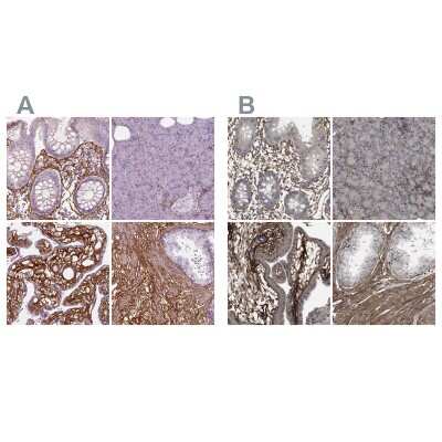 <b>Independent Antibodies Validation. </b>Immunohistochemistry-Paraffin: Collagen VI alpha 2 Antibody [NBP2-58879] - Staining of human gastrointestinal, pancreas, placenta and prostate using Anti-COL6A2 antibody NBP2-58879 (A) shows similar protein distribution across tissues to independent antibody NBP1-90951 (B).