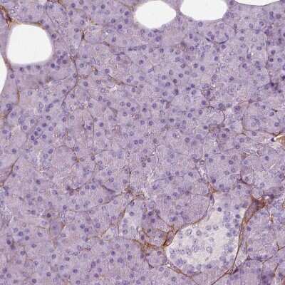 Immunohistochemistry-Paraffin: Collagen VI alpha 2 Antibody [NBP2-58879] - Staining of human pancreas shows only very weak positivity in exocrine glandular cells.