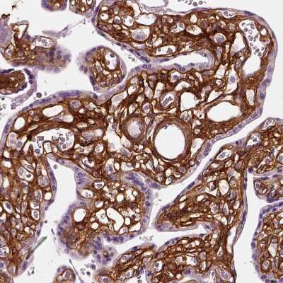 Immunohistochemistry-Paraffin: Collagen VI alpha 2 Antibody [NBP2-58879] - Staining of human placenta shows strong positivity in extracellular matrix in chorionic vlli.