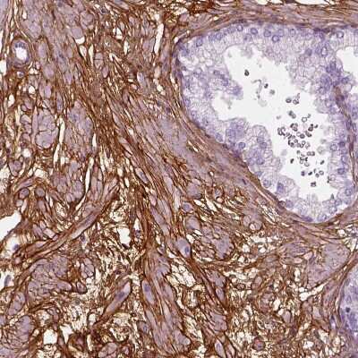 Immunohistochemistry-Paraffin: Collagen VI alpha 2 Antibody [NBP2-58879] - Staining of human prostate shows strong membranous positivity in smooth muscle cells.