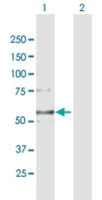 Western Blot: Collagen VI alpha 2 Antibody [H00001292-B02P] - Analysis of COL6A2 expression in transfected 293T cell line by COL6A2 polyclonal antibody.  Lane 1: COL6A2 transfected lysate(47.50 KDa). Lane 2: Non-transfected lysate.