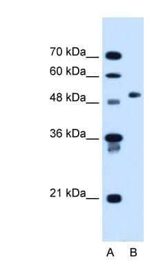 Western Blot: Collagen VI alpha 2 Antibody [NBP1-54614] - HepG2 cell lysate, concentration 1.25ug/ml.