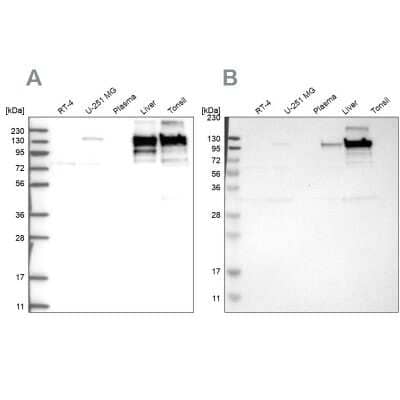 <b>Independent Antibodies Validation. </b>Western Blot: Collagen VI alpha 2 Antibody [NBP2-55655] - Analysis using Anti-COL6A2 antibody NBP2-55655 (A) shows similar pattern to independent antibody NBP1-90951 (B).