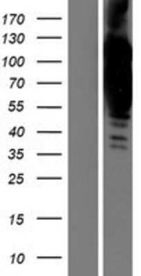 Western Blot: Collagen VI alpha 2 Overexpression Lysate (Adult Normal) [NBP2-05798] Left-Empty vector transfected control cell lysate (HEK293 cell lysate); Right -Over-expression Lysate for Collagen VI alpha 2.