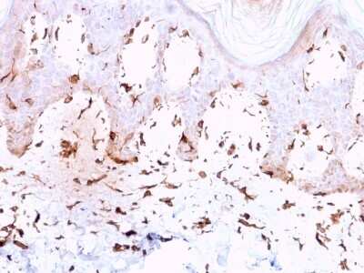 Immunohistochemistry-Paraffin: Collagen VII Antibody (LH7.2) - Azide and BSA Free [NBP3-08278] - Formalin-fixed, paraffin-embedded human Skin stained with Collagen VII Mouse Monoclonal Antibody (LH7.2).