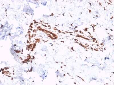 Immunohistochemistry-Paraffin: Collagen VII Antibody (LH7.2) - Azide and BSA Free [NBP3-08278] - Formalin-fixed, paraffin-embedded human Skin stained with Collagen VII Mouse Monoclonal Antibody (LH7.2).
