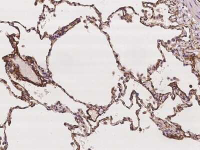 Immunohistochemistry-Paraffin: Collagen VIII alpha 1 Antibody [NBP2-97252] - Immunochemical staining of human Collagen VIII alpha 1 in human lung with rabbit polyclonal antibody at 1:100 dilution, formalin-fixed paraffin embedded sections.