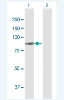 Western Blot: Collagen VIII alpha 1 Antibody [H00001295-B01P-50ug] - Analysis of COL8A1 expression in transfected 293T cell line (H00001295-T01) by COL8A1 MaxPab polyclonal antibody.  Lane 1: COL8A1 transfected lysate(81.84 KDa). Lane 2: Non-transfected lysate.