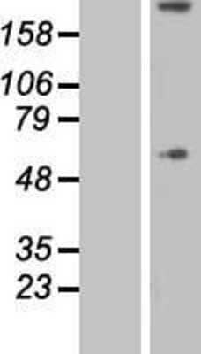 Western Blot Collagen VIII alpha 1 Overexpression Lysate