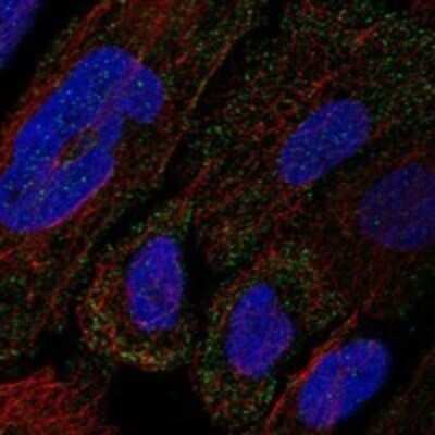 Immunocytochemistry/ Immunofluorescence Collagen XII alpha1 Antibody