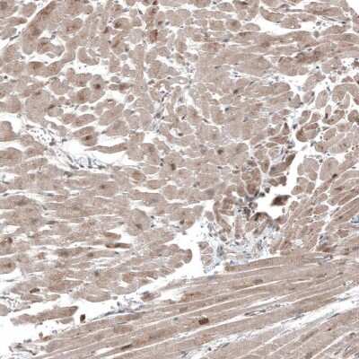 Immunohistochemistry-Paraffin: Collagen XII alpha1 Antibody [NBP1-88062] - Staining of human Heart muscle shows moderate cytoplasmic positivity in cardiomyocytes.