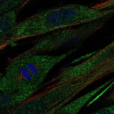 Immunocytochemistry/Immunofluorescence: Collagen XXI Antibody [NBP1-91015] - Staining of human cell line ASC TERT1 shows localization to cytosol.