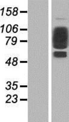 Western Blot: Collagen XXI Overexpression Lysate (Adult Normal) [NBP2-06174] Left-Empty vector transfected control cell lysate (HEK293 cell lysate); Right -Over-expression Lysate for Collagen XXI.