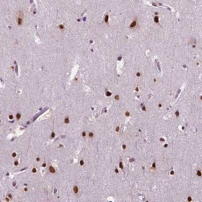 Immunohistochemistry: Collagen XXIII alpha 1 Antibody [NBP2-38111] - Staining of human cerebral cortex shows strong nuclear positivity in neuronal and glial cells.