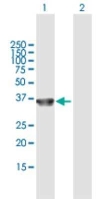 Western Blot: Collagen XXIII alpha 1 Antibody [H00091522-B01P] - Analysis of COL23A1 expression in transfected 293T cell line by COL23A1 polyclonal antibody.  Lane 1: COL23A1 transfected lysate(33.99 KDa). Lane 2: Non-transfected lysate.