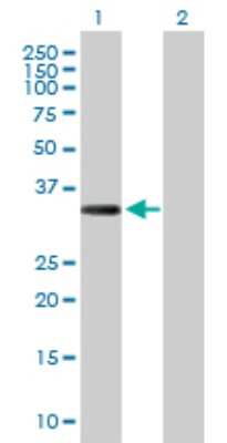 Western Blot: Collagen XXIII alpha 1 Antibody [H00091522-D01P] - Analysis of COL23A1 expression in transfected 293T cell line by COL23A1 polyclonal antibody.Lane 1: COL23A1 transfected lysate(30.70 KDa).Lane 2: Non-transfected lysate.