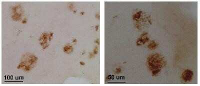 Immunohistochemistry: Collagen XXV Antibody [NB300-289] - Immunostain of the neocortex of Alzheimer's diseased brain sections (floating, fixed with 10% formalin for 24 hrs) using NB 300-289.  At high magnification, NB 300-289 stains senile plaques.