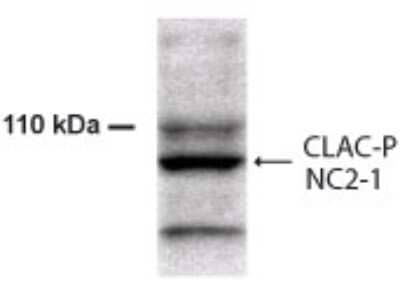 Western Blot: Collagen XXV Antibody [NB300-248] - Analysis of NC2-2 region of human and mouse CLAC-P.  Detects bands of 50, 70 and 100 kDa in SPs of Alzheimer diseased brain.